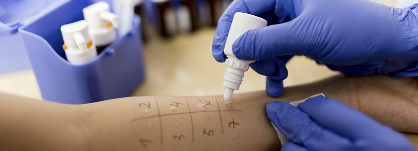 prick test
