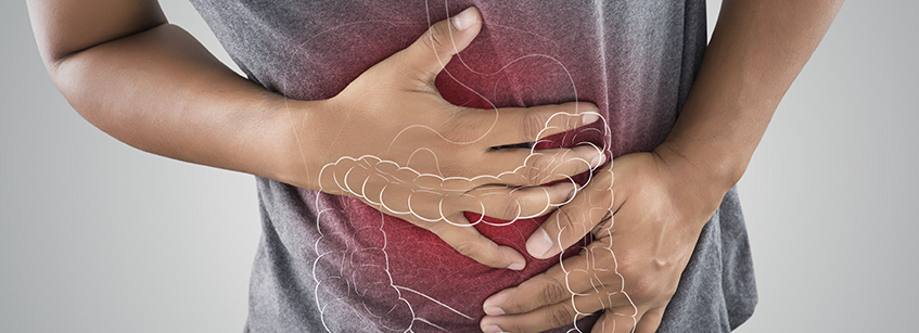 colon irritable, sintomas intestino irritable, sindrome del intestino irritable