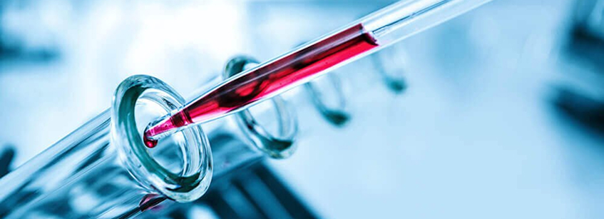 dolor de cabeza por alimentos